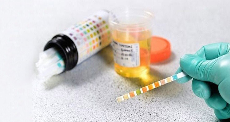 urine-test